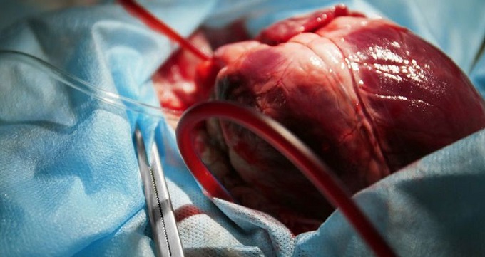 سیستم الکتریکی قلب
