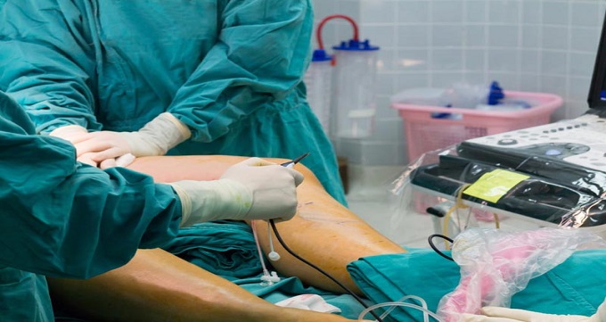 مراقبت های بعد از آنژیوگرافی