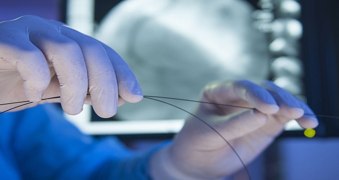 هزینه آنژیوگرافی در تهران