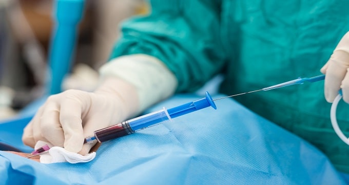 عوارض آنژیوپلاستی