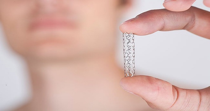 بهترین دکتر آنژیوپلاستی در تهران چه کاری انجام می دهد ؟